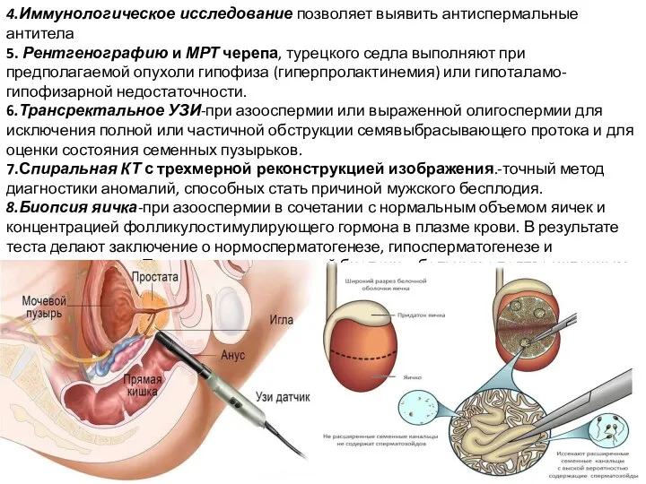 4.Иммунологическое исследование позволяет выявить антиспермальные антитела 5. Рентгенографию и МРТ черепа,