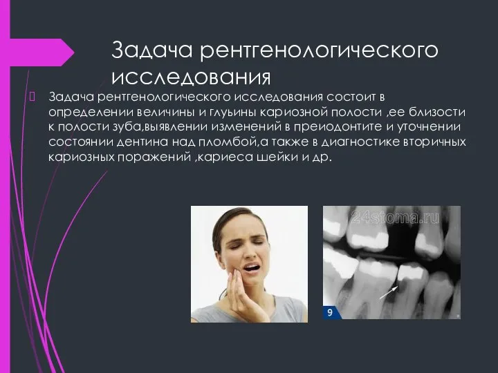 Задача рентгенологического исследования Задача рентгенологического исследования состоит в определении величины и