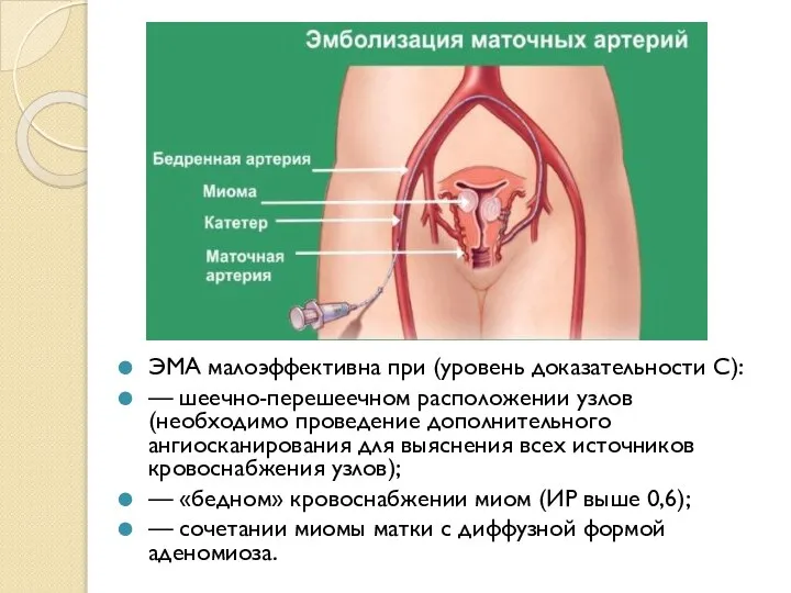 ЭМА малоэффективна при (уровень доказательности С): — шеечно-перешеечном расположении узлов (необходимо