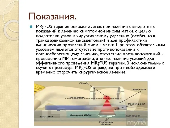 Показания. MRgFUS терапия рекомендуется: при наличии стандартных показаний к лечению симптомной