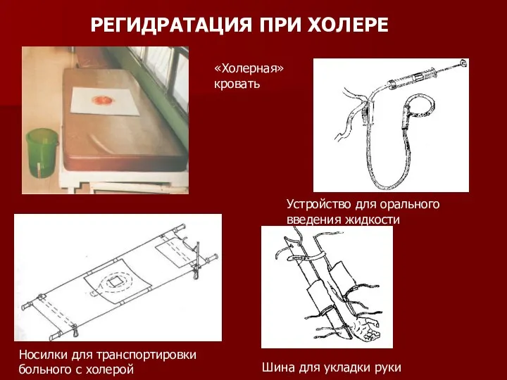 РЕГИДРАТАЦИЯ ПРИ ХОЛЕРЕ «Холерная» кровать Носилки для транспортировки больного с холерой