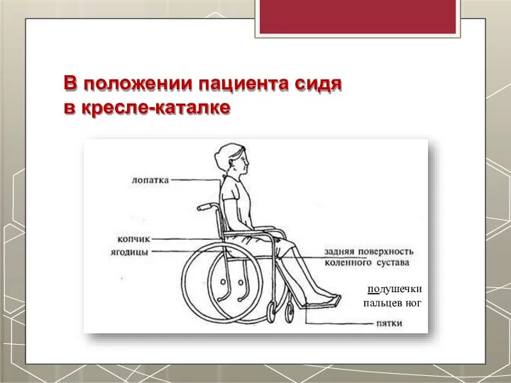 В положении пациента сидя в кресле-каталке подушечки пальцев ног