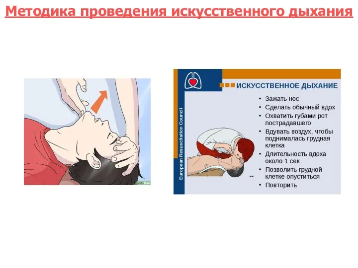 Методика проведения искусственного дыхания