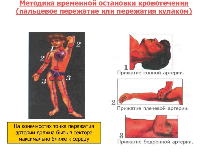 Методика временной остановки кровотечения (пальцевое пережатие или пережатия кулаком) На конечностях