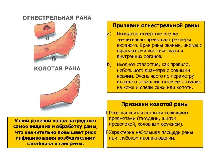 Узкий раневой канал затрудняет самоочищение и обработку раны, что значительно повышает