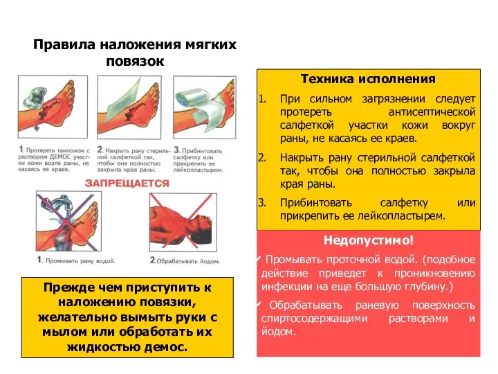 Правила наложения мягких повязок Прежде чем приступить к наложению повязки, желательно