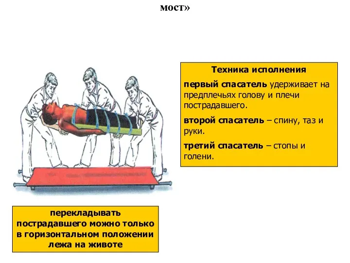 Перекладывание пострадавшего способом «Нидерландский мост» перекладывать пострадавшего можно только в горизонтальном