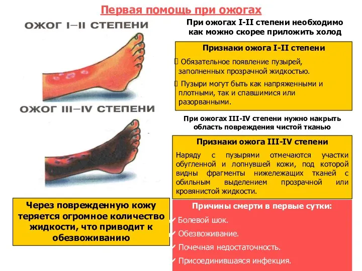 Первая помощь при ожогах Через поврежденную кожу теряется огромное количество жидкости,