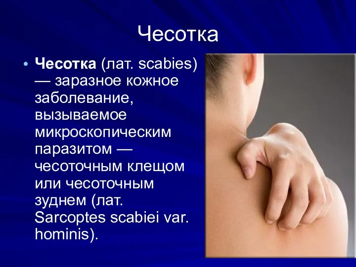 Чесотка Чесотка (лат. scabies) — заразное кожное заболевание, вызываемое микроскопическим паразитом