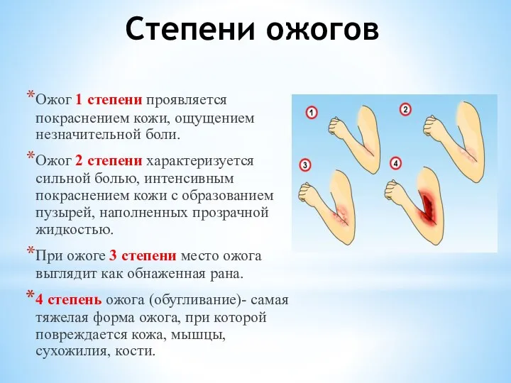 Степени ожогов Ожог 1 степени проявляется покраснением кожи, ощущением незначительной боли.