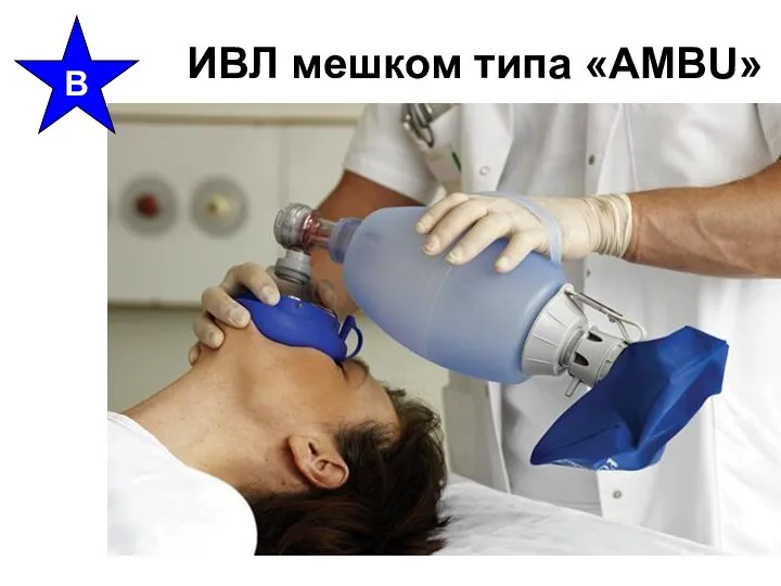 ИВЛ мешком типа «AMBU» B