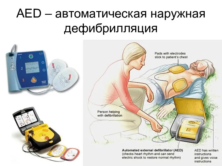 AED – автоматическая наружная дефибрилляция