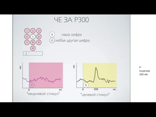 P- позитив 300 мс
