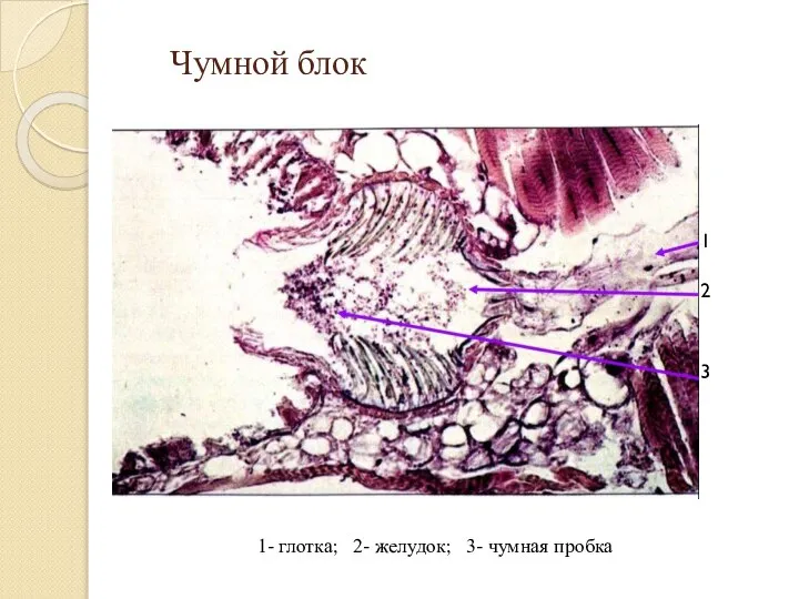 Чумной блок 1- глотка; 2- желудок; 3- чумная пробка 1 2 3