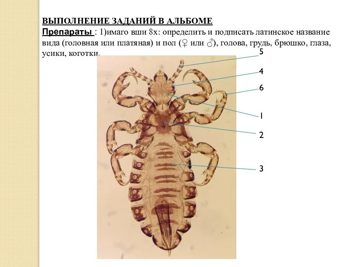 ВЫПОЛНЕНИЕ ЗАДАНИЙ В АЛЬБОМЕ Препараты : 1)имаго вши 8х: определить и