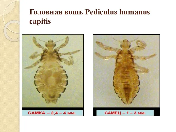 Головная вошь Pediculus humanus capitis