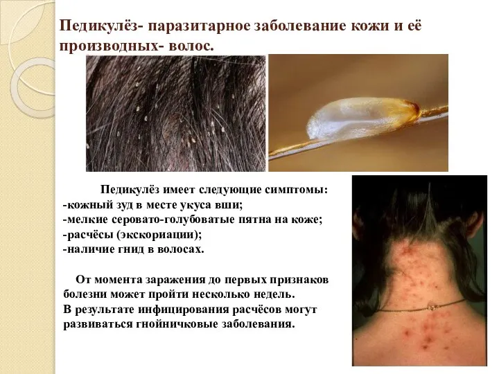 Педикулёз- паразитарное заболевание кожи и её производных- волос. Педикулёз имеет следующие