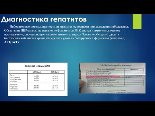 Диагностика гепатитов Лабораторные методы диагностики являются основными при выявлении заболевания. Обязателен