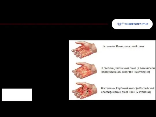 Термические (тепловые) ожоги – травма кожи или других тканей, возникающая под
