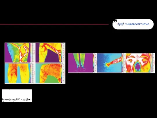 Колонтитул в ангиоархитектонике * Розенфельд Л.Г. и др. Дистанционная инфракрасная термография