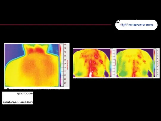 Колонтитул в пульмонологии * Розенфельд Л.Г. и др. Дистанционная инфракрасная термография
