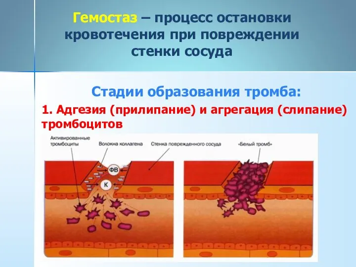 Гемостаз – процесс остановки кровотечения при повреждении стенки сосуда Стадии образования