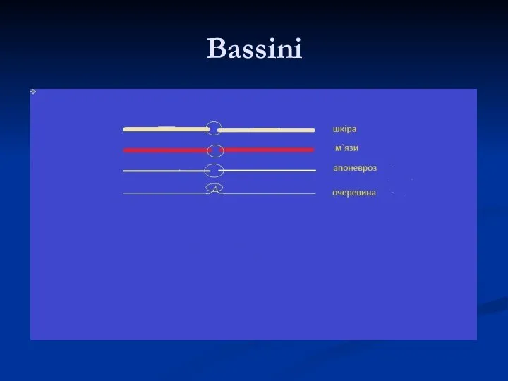 Bassini