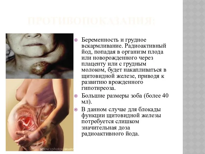 ПРОТИВОПОКАЗАНИЯ: Беременность и грудное вскармливание. Радиоактивный йод, попадая в организм плода