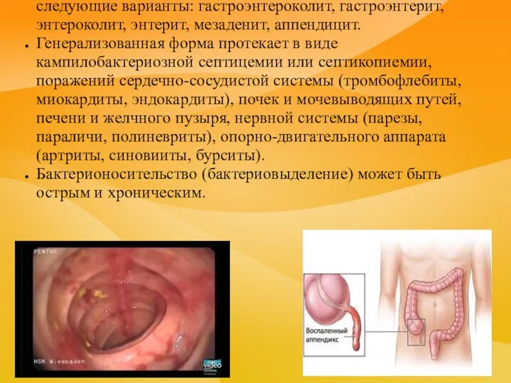 Локализованная (гастроинтестинальная) форма включает следующие варианты: гастроэнтероколит, гастроэнтерит, энтероколит, энтерит, мезаденит,