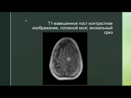 T1-взвешенное пост контрастное изображение, головной мозг, аксиальный срез