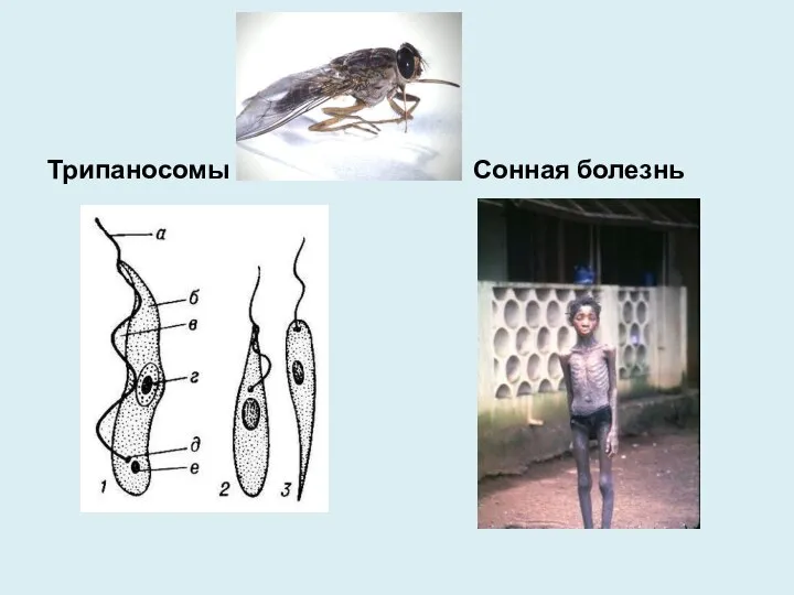 Трипаносомы Сонная болезнь