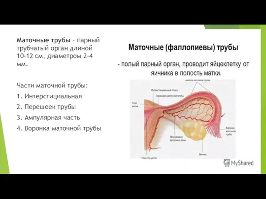 Маточные трубы – парный трубчатый орган длиной 10-12 см, диаметром 2-4