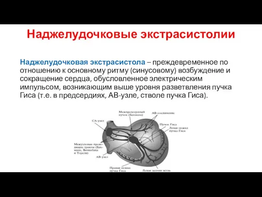 Наджелудочковые экстрасистолии Наджелудочковая экстрасистола – преждевременное по отношению к основному ритму