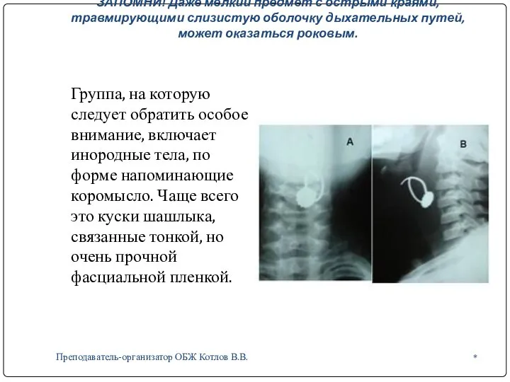 ЗАПОМНИ! Даже мелкий предмет с острыми краями, травмирующими слизистую оболочку дыхательных