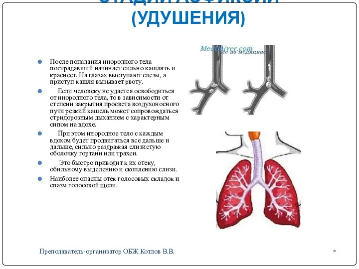 СТАДИИ АСФИКСИИ (УДУШЕНИЯ) * Преподаватель-организатор ОБЖ Котлов В.В. После попадания инородного