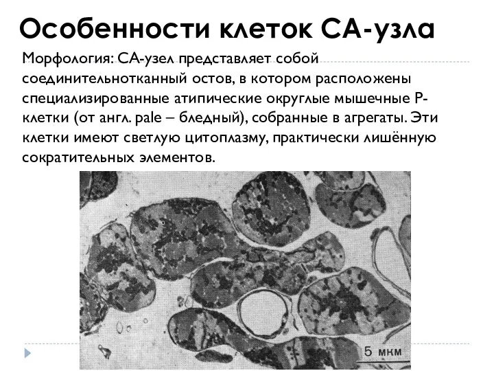 Особенности клеток СА-узла Морфология: СА-узел представляет собой соединительнотканный остов, в котором