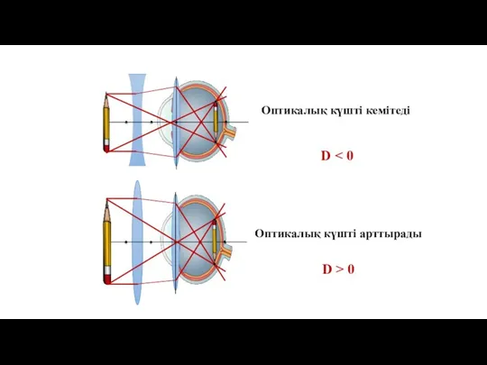 Оптикалық күшті кемітеді Оптикалық күшті арттырады D D > 0