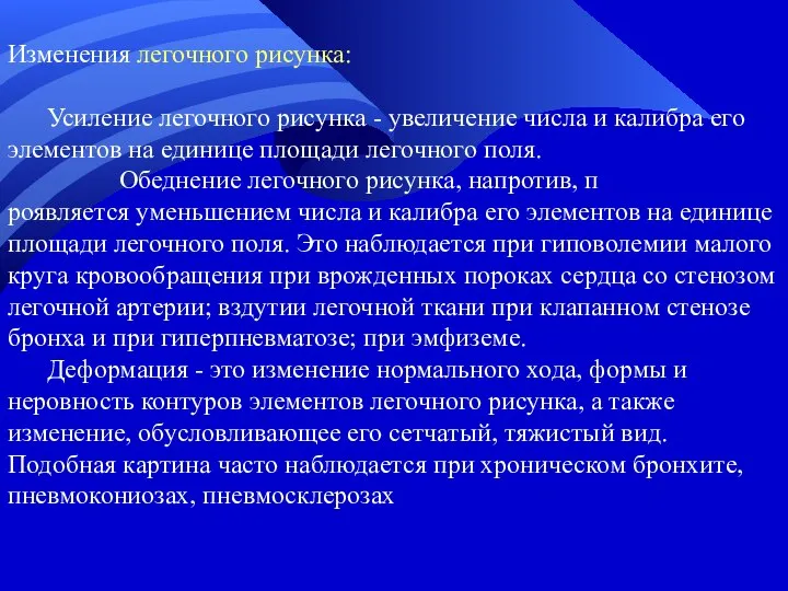 Изменения легочного рисунка: Усиление легочного рисунка - увеличение числа и калибра