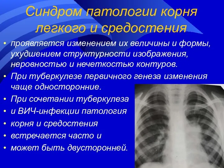 Синдром патологии корня легкого и средостения проявляется изменением их величины и