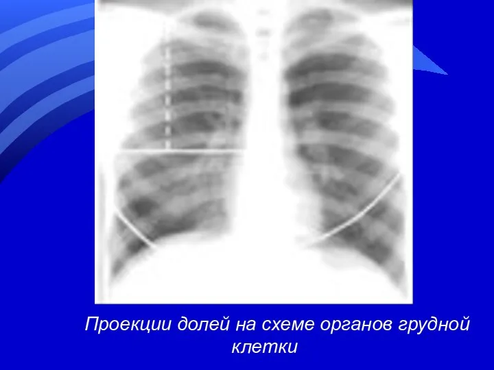 Проекции долей на схеме органов грудной клетки