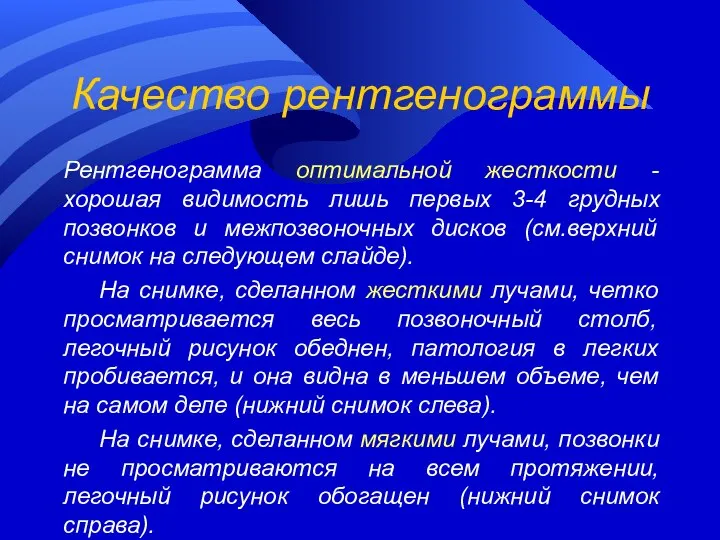 Качество рентгенограммы Рентгенограмма оптимальной жесткости - хорошая видимость лишь первых 3-4