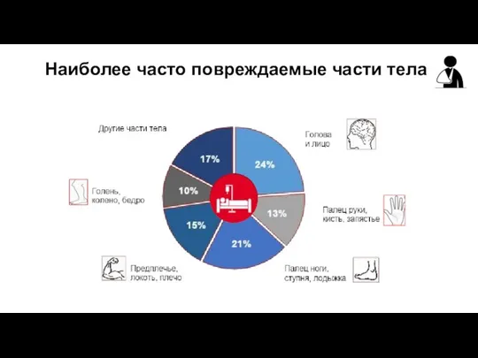 Наиболее часто повреждаемые части тела