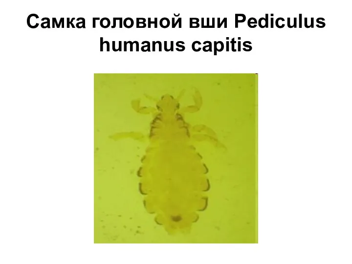 Самка головной вши Pediculus humanus capitis