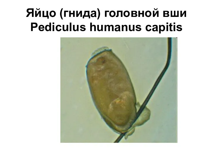 Яйцо (гнида) головной вши Pediculus humanus capitis
