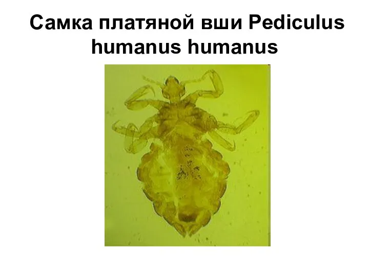 Самка платяной вши Pediculus humanus humanus