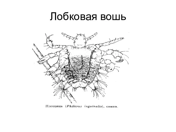 Лобковая вошь