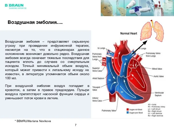 Воздушная эмболия – представляет серьезную угрозу при проведении инфузионной терапии, несмотря