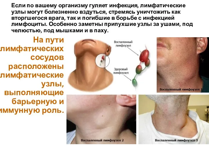 Если по вашему организму гуляет инфекция, лимфатические узлы могут болезненно вздуться,