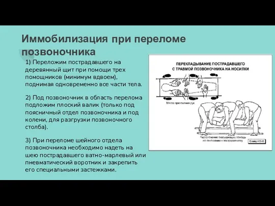 Иммобилизация при переломе позвоночника 1) Переложим пострадавшего на деревянный щит при