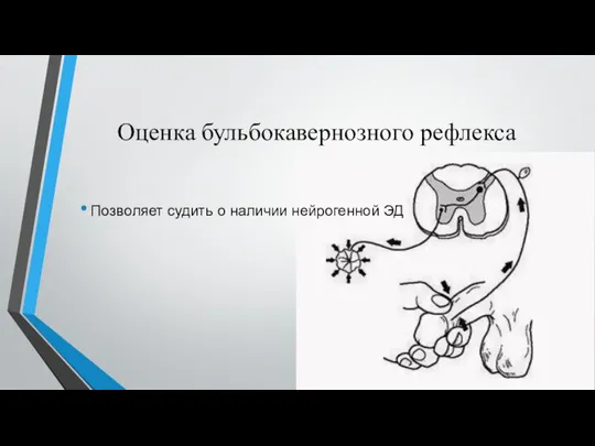 Оценка бульбокавернозного рефлекса Позволяет судить о наличии нейрогенной ЭД